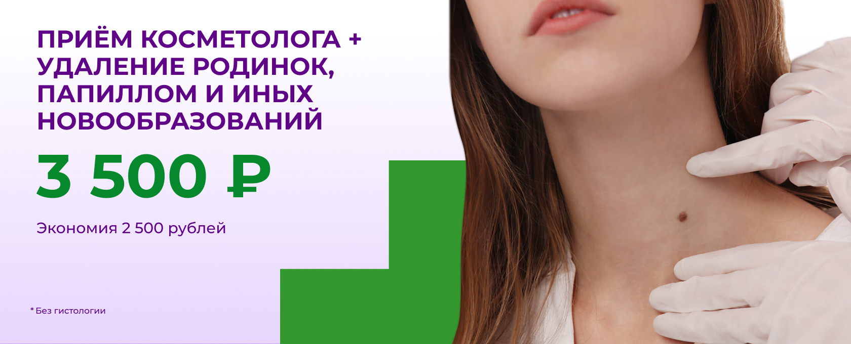 Приём косметолога удаление родинок, папиллом, новообразований